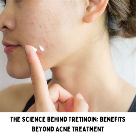 Tretinoin Gel vs Cream: Which Formulation Is Best? | Clinikally