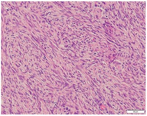 Ovarian Fibrothecoma in a Mare-Case Report[v1] | Preprints.org