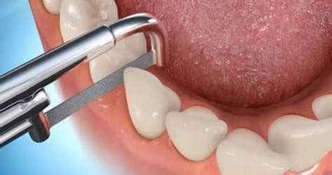 Home [academy.odontoaligners.in]