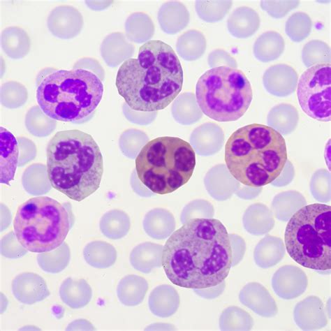 White Blood Cell Lab Values