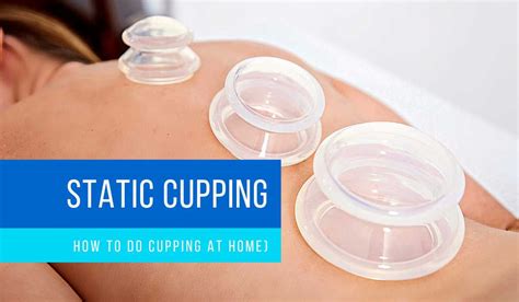 Image result for Cupping Tutorial