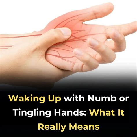 Waking Up With Numb Hands