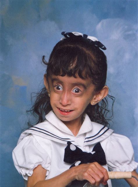 'Online bullies called me the world's ugliest woman' - Lizzie Velasquez ...