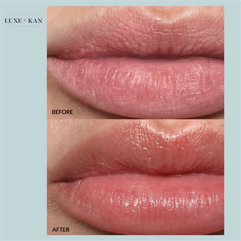 REFY Lip Buff – Luxe by Kan