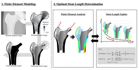 Personalized Stem Length Optimization in Hip Replacement: A Microscopic ...