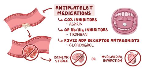 Is Plavix An Anticoagulant