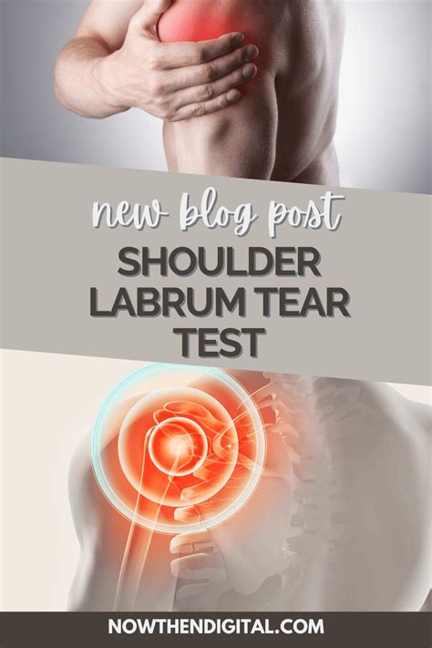 Labrum Test 的图像结果