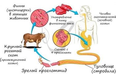 Памятка для населения Финноз (цистицеркоз)