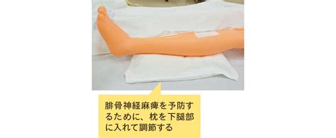 大動脈バルーンパンピング： IABP | ドレーン・カテーテル・チューブ管理 | 看護roo![カンゴルー]