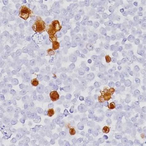 HSV Simplex 2 的图像结果