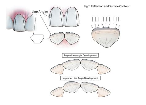 Line Angle Teeth 的图像结果
