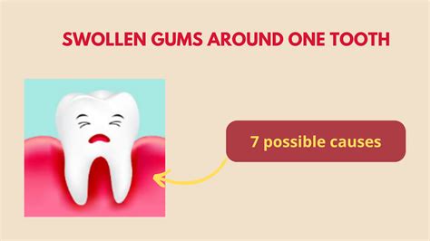 Swollen Gums Around One Tooth: 7 Possible Causes