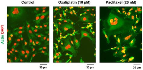 Intratumor Heterogeneity and Treatment Resistance of Solid Tumors with ...