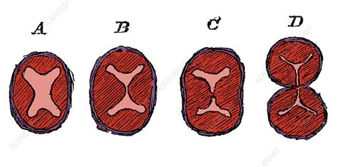 Image result for Heart Development Disorders