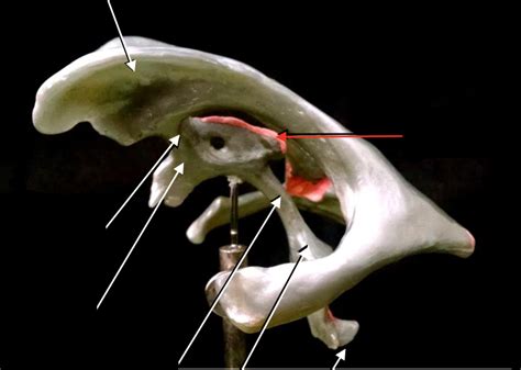 CSF Ventricular System 的图像结果