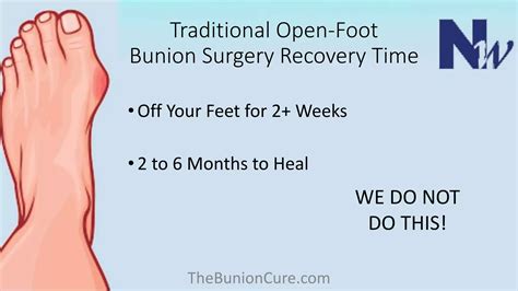Bunion Surgery Recovery Time | PPTX
