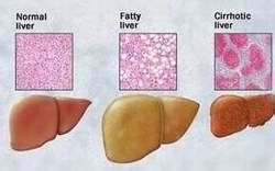 Liver Function Tests