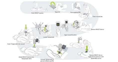 Student Builds Life-Saving Device That Can Instantly Stop Bleeding From ...