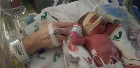 Baby At 29 Weeks Premature