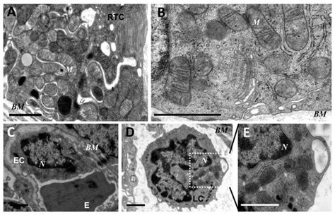 Antioxidants | Special Issue : Mitochondria-Targeted Antioxidants