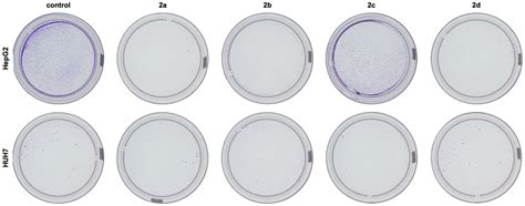 Hexokinase 2 Inhibition and Biological Effects of BNBZ and Its ...