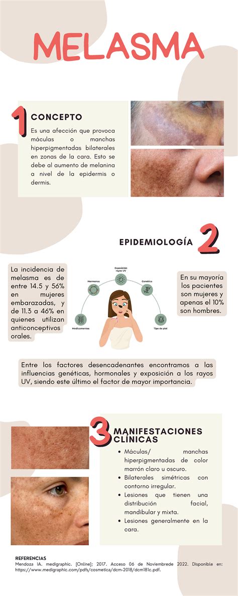 Que Es Melasma