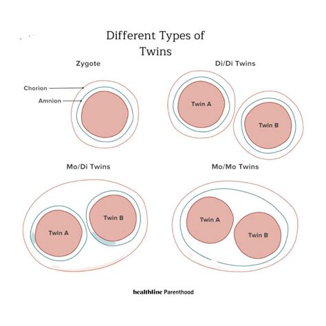 What Are Mono-Mono Twins? | Twiniversity #1 Parenting Twins Site