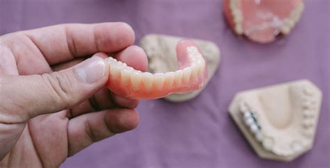 Types of Dentures: Find the Right Solution for Your Smile