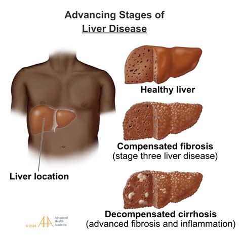 Globulin: Diagnostic Significance and Clinical Insights – Advanced Health Academy