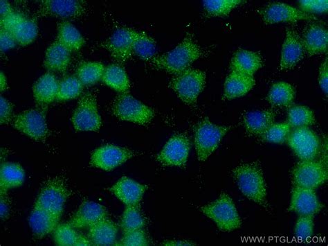 BNIP2 antibody (10361-1-AP) | Proteintech