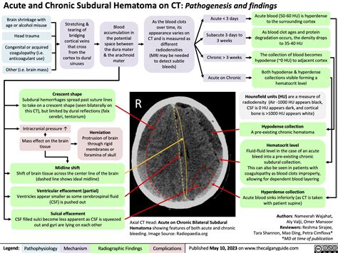 Dura Mater Subdural