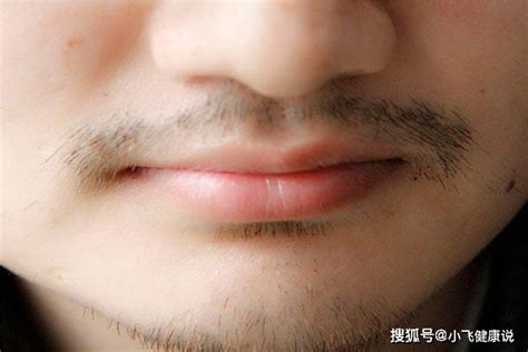 男性胡须长得快 和什么原因有关？-健康世界-万维读者网（电脑版）