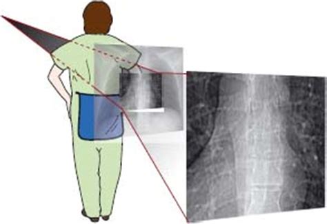 Image result for Fluoroscopy Magnification