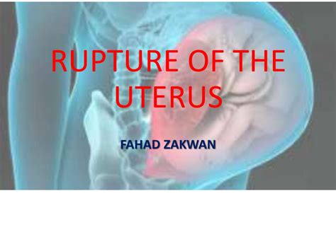 Rupture of the uterus - Obg question answers - Bsc.nursing - Studocu