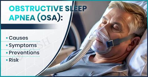Image result for Obstructive Sleep Apnea