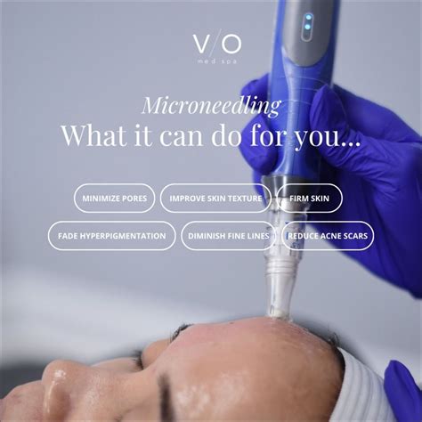 VIO Med Spa Fort Myers on Instagram: "Perfect for every skin journey 🌱 ...