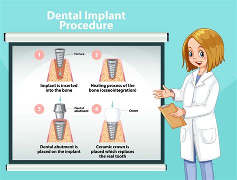 Get Dental Implants in 4 easy steps at Holistic Smile Care - Holistic Smile Care