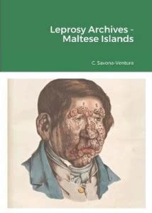 Leprosy Archives - Maltese Islands: Buy Leprosy Archives - Maltese ...