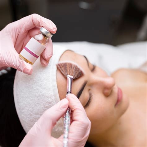 Light Acid Peel