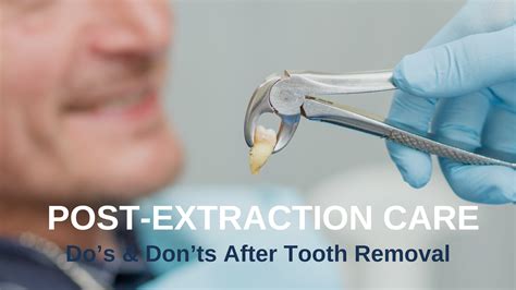Post-Extraction Care in Bangalore – Do’s & Don’ts After Tooth Removal ...