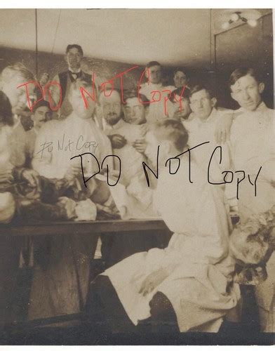 Image result for Dissection Human Postmortem