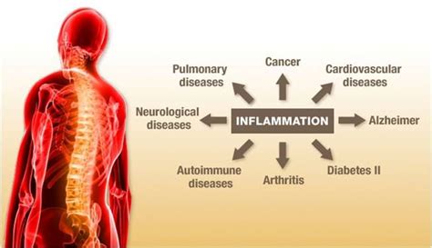 Image result for hormones affecting inflammation in joints
