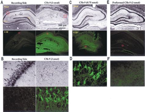Image result for Complement Membrane Attack Complex