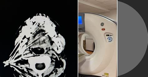 TDM Scanner 的图像结果