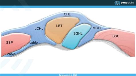 Learn to Scan the Rotator Interval and Identify Pathology | Clarius | Blog Post