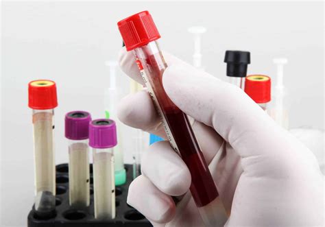 Steroid Addiction: Signs, Symptoms, Effects and Treatment