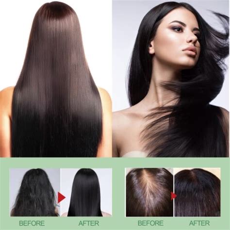 Buy Rice Water For Hair Growth Vegan Conditioner Spray Hair Care ...