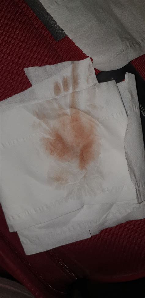 What Does Implantation Bleeding Look Like When You Wipe