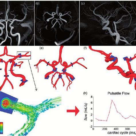 Image result for C ViPR