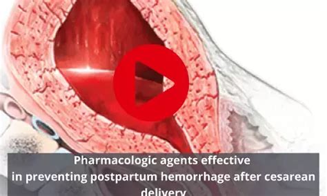 Obstetrics and Gynaecology